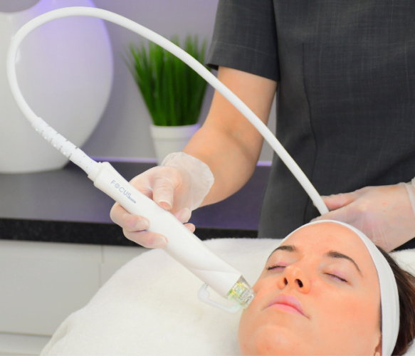 How Does Radiofrequency Microneedling Work? · Lynton Clinic