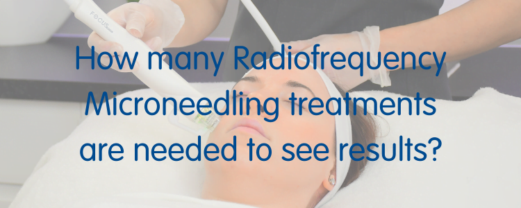 How many Radiofrequency Microneedling treatments are needed to see results?