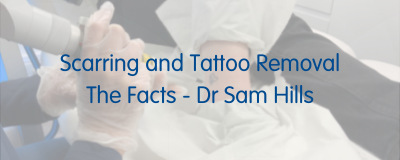 Tattoo Removal Scars